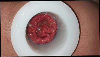 Video 1418787903: plug gaping ass, plug anal gaping, anal plug pov, anal plug solo, anal gape fetish, solo male pov, gaping ass fucked anal, amateur pov ass fuck, gaping ass hole anal, anal gaping huge toys, hardcore anal gape, gaping ass hole stretched, pink anal plug, plug anal training