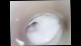 Video 1148099945: urethra pee, pee hole sounding