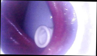 Video 1184862501: guts deep, big gut, big ass deep anal, ass swallows big, big ass straight, camera ass