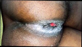 Video 201228601: anal prolapse, straight anal, anal hd