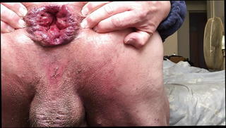 Video 1165482901: anal sex ass gaping, gaping anal toying, ass big anal gapes, amateur anal gape, homemade anal gape, gay anal gape, bottle anal gaping, anal gape hd