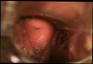 Video 18591001: babes speculum, speculum exam, medical speculum, doctor, amateur babe, babe straight, babe close