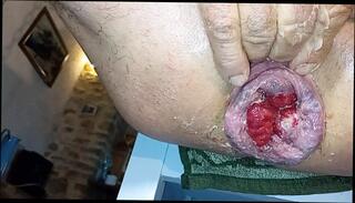 Video 1648483131: gapes prolapse fisting anal, dildo fisting prolapse, anal dildos gape huge, anal prolapse pump, huge dildo solo anal, solo toy dildo, gay solo dildo, solo amateur dildoing, mature dildo solo, huge monster toy dildo, anal extreme huge dildo, fisting dildo insertions, monster dildo ass, anal dildo hd, dildoing french