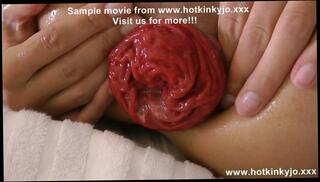 Video 1576433151: anal prolapse, toys prolapse, prolapse hardcore, anal balls toy, anal sex toys, anal sex straight, anal toys hd