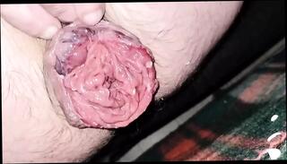 Video 1622878001: fisting gape prolapse, anal gape prolapse, gaping anally masturbates, gay anal gape, anal gape close, anal gape hd, wet prolapse, stretching prolapse