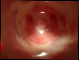 Watch the video about Cup in vagina