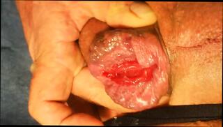 Video 1588204671: fisting gape prolapse, gaping prolapsed ass, anal prolapse pump, solo ass gape, grandpa solo, gaping ass gay, amateur anal gape, ass gaping european, anal gape hd, fat ass solo, old grandpa gay, german amateur man solo, gay bear solo, ass action