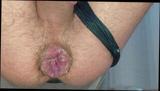 Video 1656876505: prolapse fisting ass, anal fisting prolapse, twink anal fisting, gay twink fisting, sexy twink ass, twink ass dick, sexy big cock twink, twink anal orgasm, twink ass fat, twink whore, bottle prolapse, giant prolapse, prolapse queen, stretching prolapse, hardcore fisting, home fisting, amazing fisting