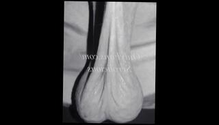 Video 1600105213: amateur solo sexy, suck amateur solo, saggy balls, ball slapping, big saggy balls, sexy solo male, best amateur solo, stretching solo, balls testicles, sexy celebrity