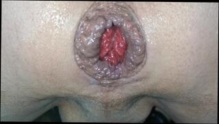 Video 1487941203: dildo anal fuck gaping, anal dildo gaping ass, dildo riding anal gaping, solo anal dildo fuck, anal dildo toy fetish, dildo ass hole gape, dildos big anal gape, solo amateur dildoing, solo male dildo, juicy gaping anal, anal gape training, fast dildo fucking, anal gape close