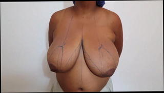 Video 1261381901: big tits doctor, big boobs doctor, doctor amateur, doctor straight, latin doctor, doctor medical, doctor ties, doctors huge, mature doctor, brunette doctor, doctor hd, tits boobs breasts, tits huge boobs natural, colombian huge tits