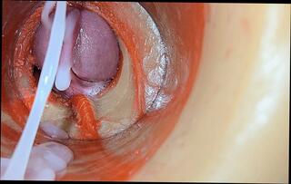 Video 1653888501: sex toy big cock, cock masturbation toy, gay cock toys, sex toy close, gay sex hd, ejaculates huge, male ejaculation