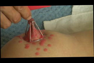 Video 30095301: wax bdsm, wax nipples, wax tits, straight bdsm, tits stretched nipple