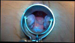 Video 180452425: speculum gaping, gaping butt hole, gay gaping hole, gaped hardcore, speculum play, gaping juicy, gay exhibitionist