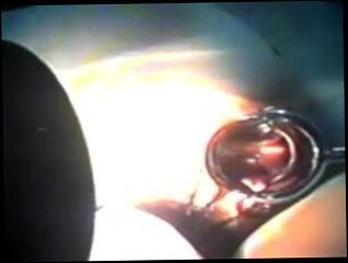 Watch the video about Zhangjiajing Nurses Maid Taiwanese Taiwan001