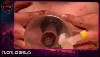 Video 1605931191: twink solo ass, solo twink boys, gay twink fetish, fetish twinks anal, young twink solo, twink boy gay sex, twink hardcore gay sex, twink toys ass hole, twink gay hunks, twink ass stretching, twink shaved ass, german twink boy, solo anal training, solo toy hd, younger twink, vacuum, vacuum big