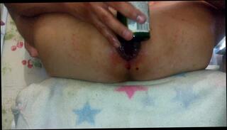 Video 258881601: gay anal sex toy, gay amateur anal sex, man anal gay sex, anal toy insertion, anal toys hd