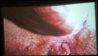 Video 372682001: wide open, gaping ass anal, ass gaping deep, anal gape hd, straight anal