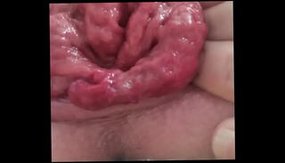 Video 1618583645: plug prolapse, plug closeup, anal butt plug fucked, butt plug anal stretching, butt plug close, plug self