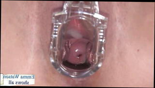 Video 969093301: emma watson, wide open, pussy gaping wide open, nice gaping, gaping european, straight pussy