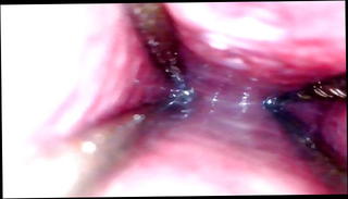 Video 1227849301: wide open, waxing penis, penis inspection, hot wax play, insertion gaping, gape hd, urethral straight, urethra insertion