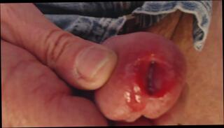 Video 250171301: gaping gay, gaping man, gape hd, penis head, slit