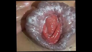 Video 822942415: prolapsed ass holes, pussy prolapse, prolapse gay, anal