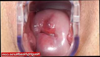 Video 178677285: milf vagina, mature milf wife, naughty mature milf, milf nurse, uniform milf, speculum