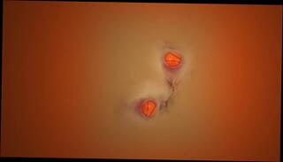 Video 226319901: balls anal gaping, gaping anal toying, gaping anal sex, anal gape close, gapes two, anal sex straight, funny sex toy, filled balls, anuses