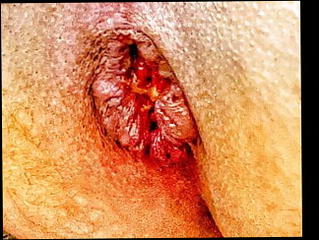 Video 1575218411: anal dildo butt plug, solo anal dildo masturbation, huge dildo butt plug, dildo ass plug, big dildo butt plug, solo toy dildo, solo shemale dildo, solo pussy dildo, solo dildo cum, solo dildo sex, cock anal dildo toy, dildos ass hole pussy, ladyboy anal dildo, stockings dildoing pussy, anal dildo hd, young shemale solo