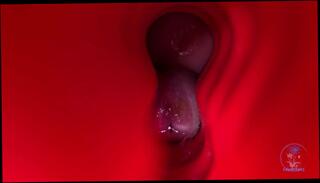 Video 1656821513: double penetration compilation, compilation solo male masturbating, cock solo compilation, fetish double penetration, hairy cock solo, solo toying compilation, amateur fetish compilation, solo masturbation oiled, solo amateur trans, hardcore double penetration, doll double penetration, double penetration close, precum compilation