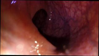 Video 1619548363: pov anal gape, solo anal gaping, vore pov, tiny pov, solo male pov, toys fisting gape, amateur anal pov, extreme anal gape, giant vore, pov 60fps, tiny college