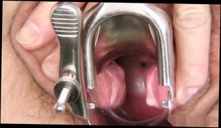 Video 73470201: gaping hairy, hairy mature straight, beautiful hairy mature, nurse gaping, gape close