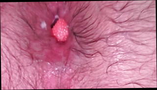 Video 1265539401: bdsm anal fisting, bdsm ball, gay bear bdsm, daddy bdsm, hd bdsm, anal whore, inside anal