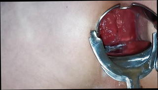 Video 1214485301: anal sex ass gaping, gaping ass hole toyed, gaping amateur ass, anal gape hd