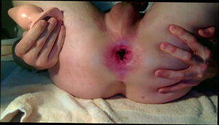 Video 557039135: anal gaping butt plug, twink gaping gay, butt plug solo, solo twink boys, solo twink plays, anal toys butt plug, gaping hole