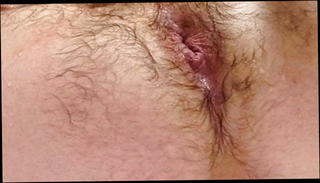 Video 1420298401: anal sex ass gaping, gaping ass hole toyed, gay gaping ass hole, gaping anally masturbates, gaping amateur ass, gaping ass hole stretched, gaping sucking, anal gape hd, insertion gaping, muscle gay anal sex, muscular gay sex, painful anal