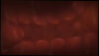 Video 1250588585: breeds furry