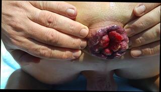 Video 242309601: gay gaping ass hole, gape ass hole extrem, ass nudist, nudist beach, gaping outdoors