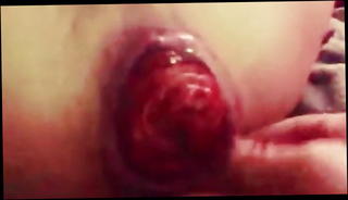 Video 1425362801: twink fucked bareback gay, twink bareback fucking amateurs, fisting gape prolapse, anal gape prolapse, twink couple bareback, muscle twinks bareback, fucking bareback hd, bareback fucking big, huge prolapse, bareback muscular, fucked raw