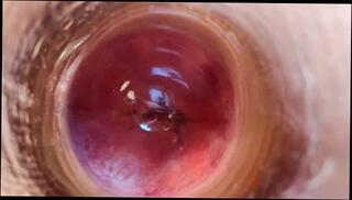 Video 1593169133: uncut twink solo, skinny twink solo, skinny ass twink, skinny amateur twink, uncut gay twink, skinny twinks anal, uncut solo male, twinks first anal gay, twink ass first time, beautiful gay twink, ass fuck