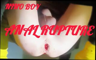 Video 1621442001: femboy dildo solo anal, sissy femboy dildo, twink sissy femboy, skinny femboy twink, skinny gay twink boys, gay twink boy fingered, solo fingering pussy masturbating, teen solo finger pussy, young skinny twink boy, twink skinny boy rough, sissy slave boy, sissy femboy amateur, sissy sex slave, uncut twink boy, big dildo solo anal, cute sissy femboy, skinny twink hard, sissy boy gay porn, handsome boy solo, gay man sissy, anal dildo hd, spreads tight ass, ass spread wide, slim ass, sweet ass, guys ass