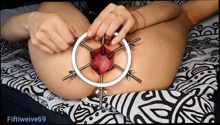 Video 1618325211: gaping prolapsed ass hole, fisting gape prolapse, anal gape prolapse, solo ass gape, ass hole masturbates solo, ass big anal gapes, amateur anal gape, solo masturbation action, solo masturbating straight, gaping ass hole stretched, gape ass hole extrem, anal gape insertion, ass gaping european, brunette anal gaping, anal gape hd, biggest gape