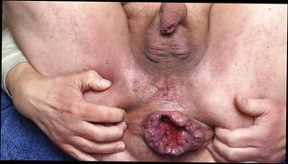 Video 1215552201: anal sex ass gaping, gaping anal toying, ass big anal gapes, amateur anal gape, homemade anal gape, gay anal gape, anal gape close, anal gape hd, creamy gaping