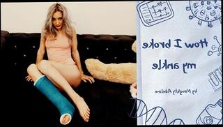 Video 1486318503: girl feet fetish, feet legs fetish, solo female feet, solo amateur girls, leg cast fetish, feet talk, broken girl