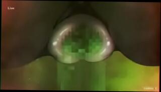 Video 1065763805: furry, best strip