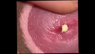 Video 1507531465: dick young boy, dirty dick, dick spreading, dirty cock, dick head