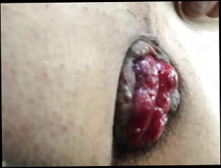 Video 1600890411: solo pumped, skinny solo, pumping sex toy, ass pumping cock, pumping cock anal, pump gay sex, solo amateur toys, ass hole pumped, pumped butt, prolapsed butt, solo toy hd