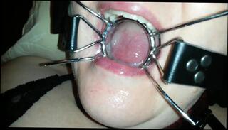 Watch the video about Spider gag facial