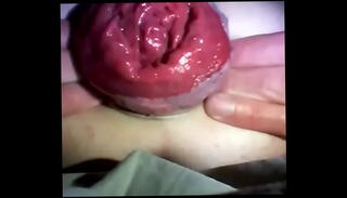 Video 844630565: anal gape prolapse, gaping prolapsed ass, solo anal gaping, gape anal boys
